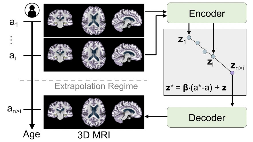MRExtrap: Longitudinal Aging of Brain MRIs using Linear Modeling in Latent Space